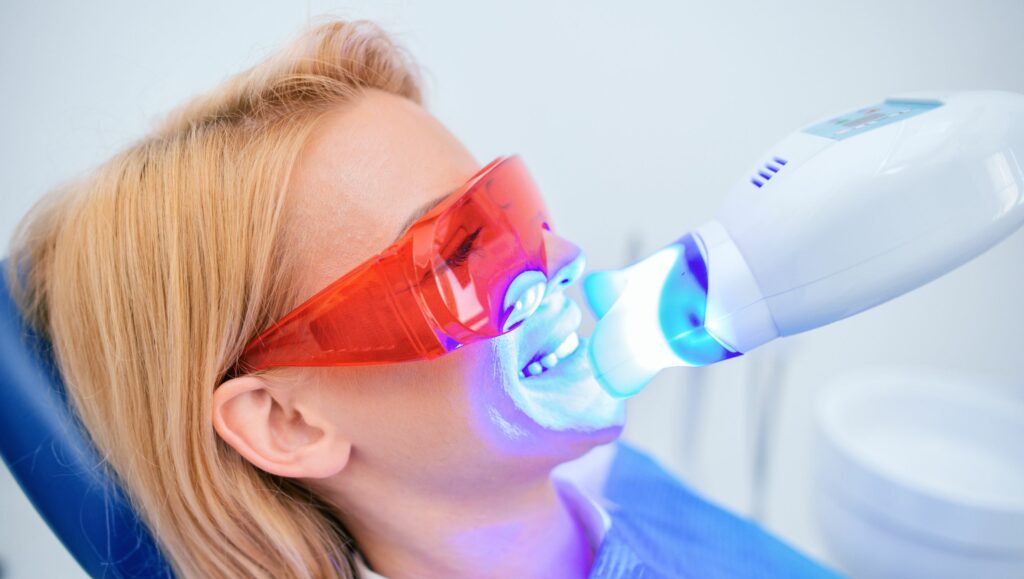 sbiancamento dentale professionale